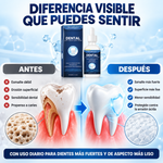 TrueRelief Dental - Reparación del esmalte, alivio de la sensibilidad, ayuda con la caries dental, y blanqueamiento natural.